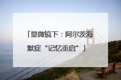 显微镜下：阿尔茨海默症“记忆重启”